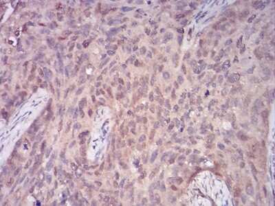 Immunohistochemistry-Paraffin: PLC-gamma 1 Antibody (3C2D11) - BSA Free [NBP2-52532]