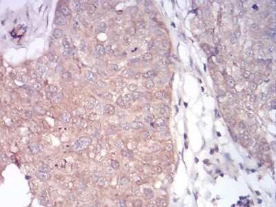 Immunohistochemistry-Paraffin: PLC-gamma 1 Antibody (3C2D11) - BSA Free [NBP2-52532]