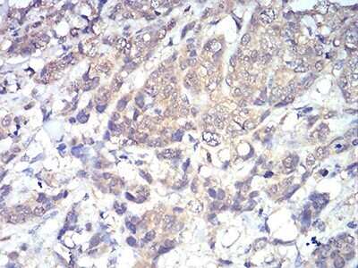 Immunohistochemistry-Paraffin: PLC-gamma 1 Antibody (3H1C10) - BSA Free [NBP2-52533]