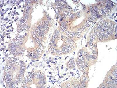 Immunohistochemistry-Paraffin: PLC-gamma 1 Antibody (3H1C10) - BSA Free [NBP2-52533]