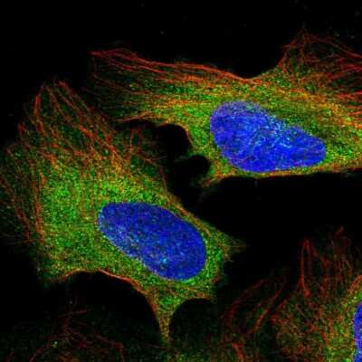 Immunocytochemistry/ Immunofluorescence: PLC-gamma 1 Antibody [NBP2-38316]