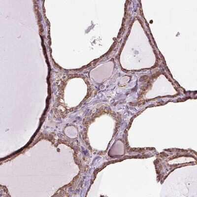 Immunohistochemistry: PLC-gamma 1 Antibody [NBP2-38316]