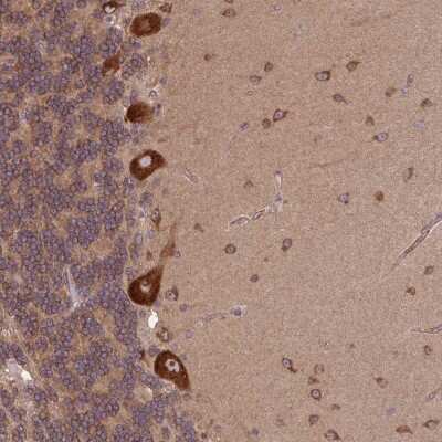 Immunohistochemistry: PLC-gamma 1 Antibody [NBP2-38317]