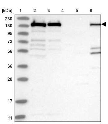 Western Blot: PLC-gamma 1 Antibody [NBP2-38317]