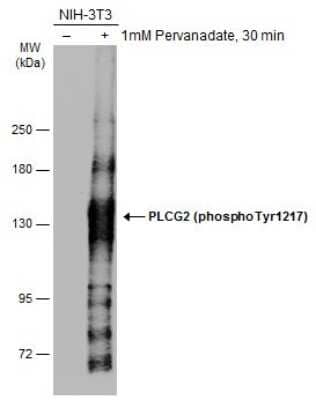 Western Blot: PLC-gamma 2 [p Tyr1217] Antibody [NBP3-13270]