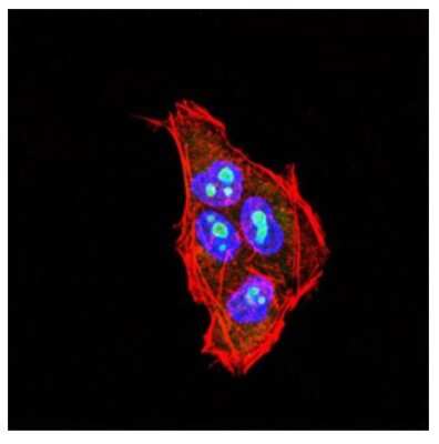 Immunohistochemistry-Paraffin: PLC-gamma 2 Antibody (1E10C11) - BSA Free [NBP2-52535]