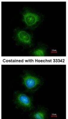 Immunocytochemistry/ Immunofluorescence: PLC-gamma 2 Antibody [NBP1-33036]