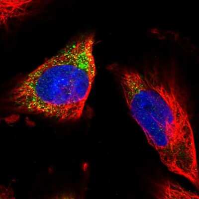 Immunocytochemistry/ Immunofluorescence: PLC-gamma 2 Antibody [NBP1-87558]