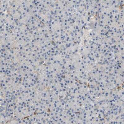 Immunohistochemistry-Paraffin: PLC-gamma 2 Antibody [NBP1-86030]