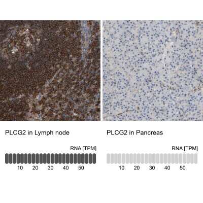 Immunohistochemistry-Paraffin: PLC-gamma 2 Antibody [NBP1-86030]