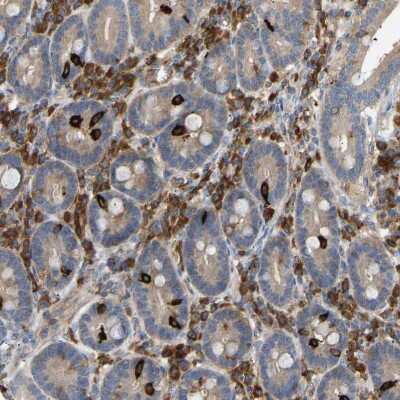 Immunohistochemistry-Paraffin: PLC-gamma 2 Antibody [NBP1-86030]