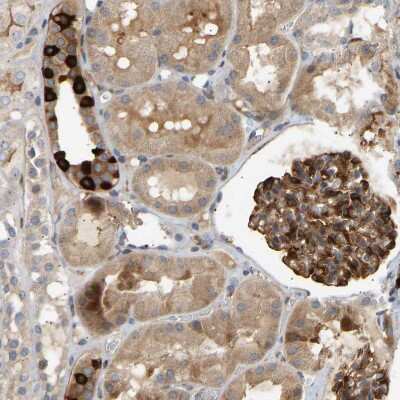 Immunohistochemistry-Paraffin: PLC-gamma 2 Antibody [NBP1-86030]