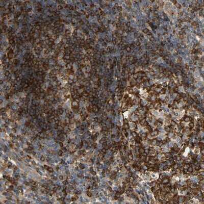 Immunohistochemistry-Paraffin: PLC-gamma 2 Antibody [NBP1-87558]