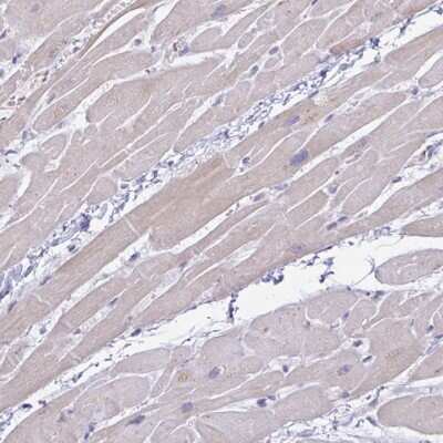 Immunohistochemistry-Paraffin: PLCD4 Antibody [NBP2-38392]