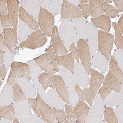 Immunohistochemistry-Paraffin: PLCD4 Antibody [NBP2-38392]