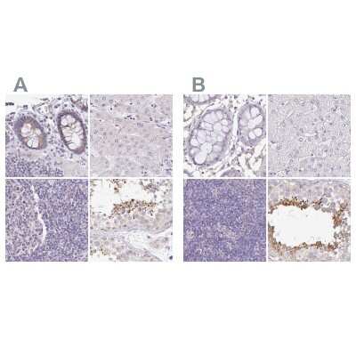 Immunohistochemistry-Paraffin: PLCD4 Antibody [NBP2-38392]