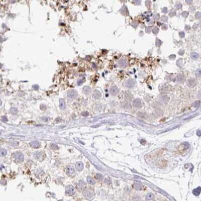 Immunohistochemistry-Paraffin: PLCD4 Antibody [NBP2-38392]