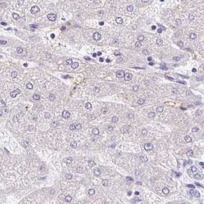 Immunohistochemistry-Paraffin: PLCD4 Antibody [NBP2-38392]