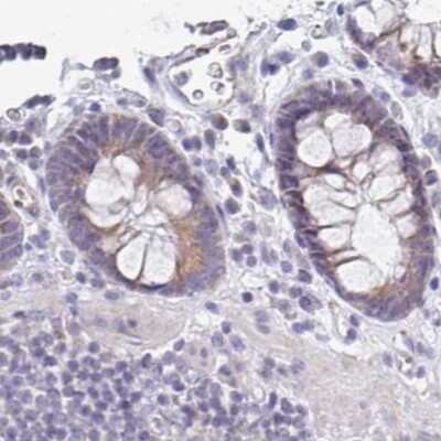 Immunohistochemistry-Paraffin: PLCD4 Antibody [NBP2-38392]