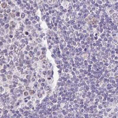 Immunohistochemistry-Paraffin: PLCD4 Antibody [NBP2-38392]