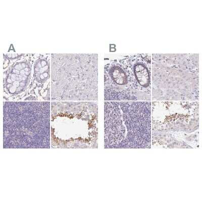 Immunohistochemistry-Paraffin: PLCD4 Antibody [NBP2-38393]