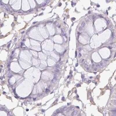 Immunohistochemistry-Paraffin: PLCD4 Antibody [NBP2-38393]