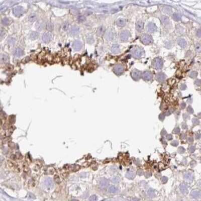 Immunohistochemistry-Paraffin: PLCD4 Antibody [NBP2-38393]