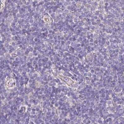 Immunohistochemistry-Paraffin: PLCD4 Antibody [NBP2-38393]