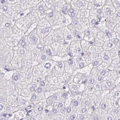 Immunohistochemistry-Paraffin: PLCD4 Antibody [NBP2-38393]