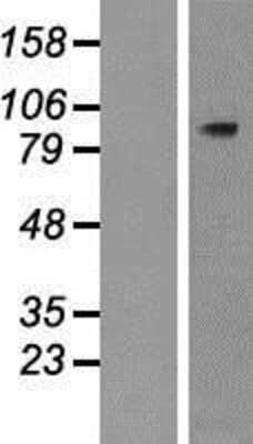 Western Blot: PLCD4 Overexpression Lysate [NBP2-05977]