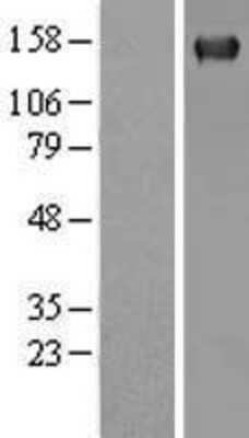 Western Blot: PLC-gamma 2 Overexpression Lysate [NBL1-14491]