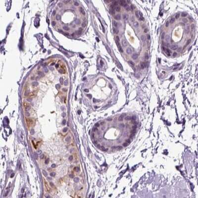 Immunohistochemistry: PLCH2 Antibody [NBP2-68945]