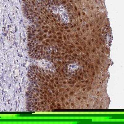 Immunohistochemistry-Paraffin: PLCL2 Antibody [NBP2-13768]