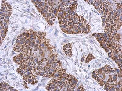 Immunohistochemistry-Paraffin: PLCL2 Antibody [NBP2-19863]