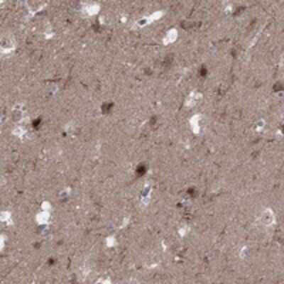 Immunohistochemistry-Paraffin: PLCL2 Antibody [NBP3-17912]