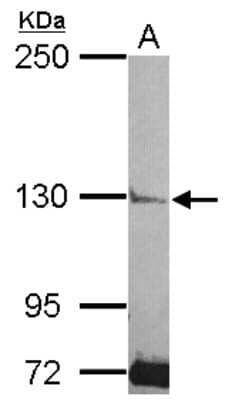 Western Blot: PLCL2 Antibody [NBP2-19863]