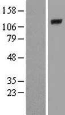 Western Blot: PLCL2 Overexpression Lysate [NBL1-14492]