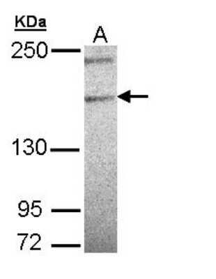 Western Blot: PLCL3 Antibody [NBP1-31586]