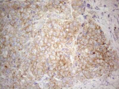 Immunohistochemistry: PLCXD1 Antibody (OTI2D7) [NBP2-46442]