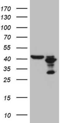 Western Blot: PLCXD1 Antibody (OTI2D7) [NBP2-46442]