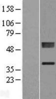 Western Blot: PLCXD1 Overexpression Lysate [NBL1-14493]