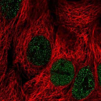 Immunocytochemistry/ Immunofluorescence: PLCXD2 Antibody [NBP2-30624]