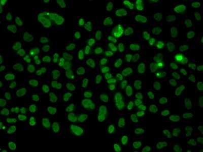 Immunocytochemistry/ Immunofluorescence: PLCXD2 Antibody - BSA Free [NBP3-04660]