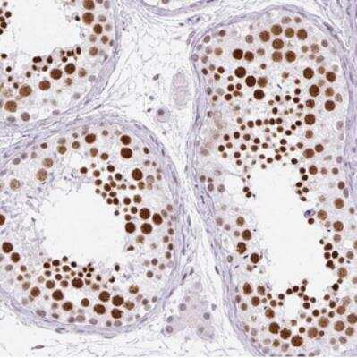 Immunohistochemistry-Paraffin: PLCXD2 Antibody [NBP2-30624]