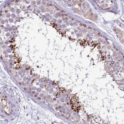 Immunohistochemistry-Paraffin: PLCXD3 Antibody [NBP2-13769]