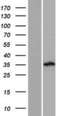 Western Blot: PLCXD3 Overexpression Lysate [NBP2-08838]