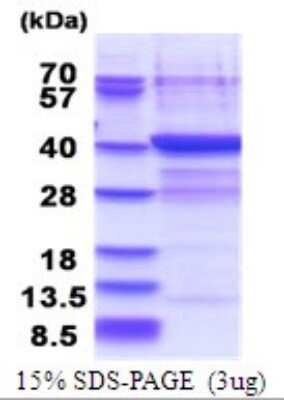 SDS-PAGE: Recombinant Human PLCXD3 His Protein [NBP2-51722]