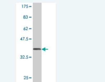 Western Blot: PLD1 Antibody (10H2) [H00005337-M02]