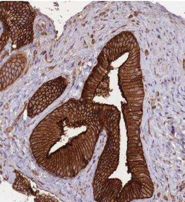 Immunohistochemistry-Paraffin: PLD1 Antibody [NBP2-34078]