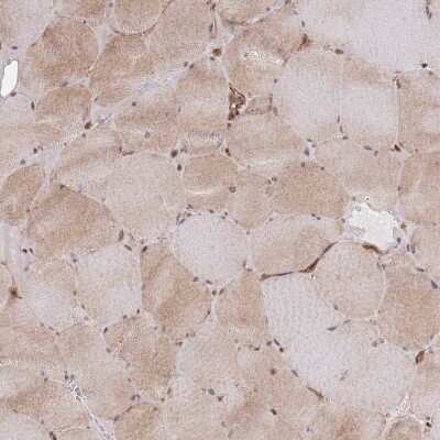 Immunohistochemistry-Paraffin: PLD1 Antibody [NBP2-34078]